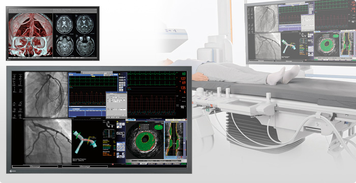 EIZO RadiForce na salę operacyjną